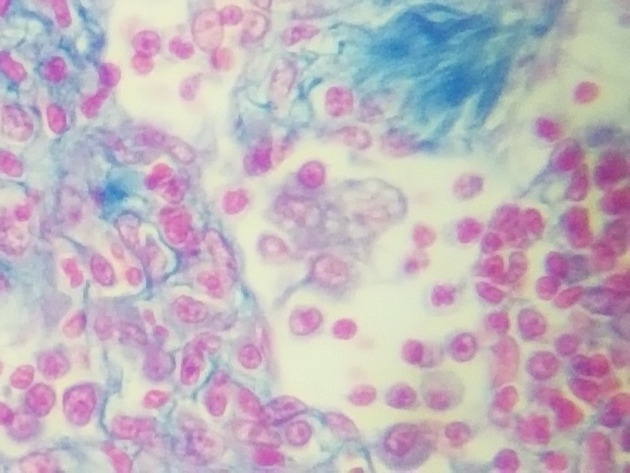 Reticular Connective Slides - Reticular Connective 08 400X